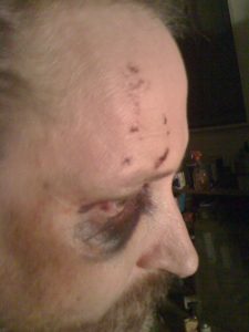 A Survey of Police Policy Manuals on Use of Force Against Uncooperative Arrestees: Baton Strikes, Target Areas, and Evolving Standards